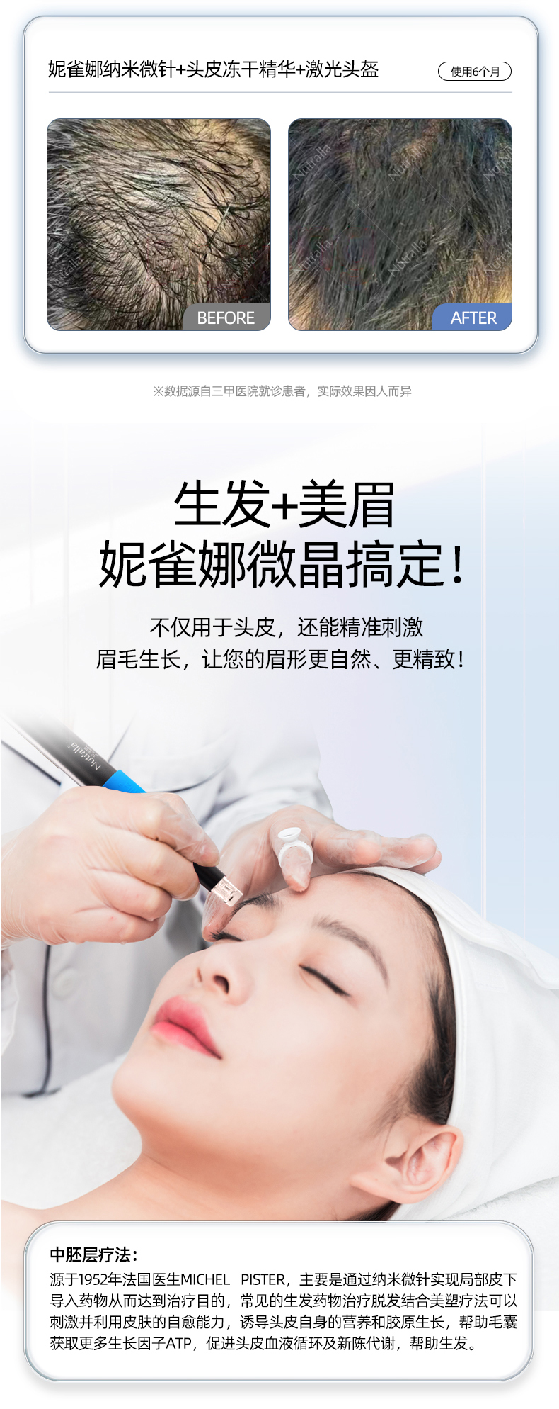 微针详情页_16.jpg