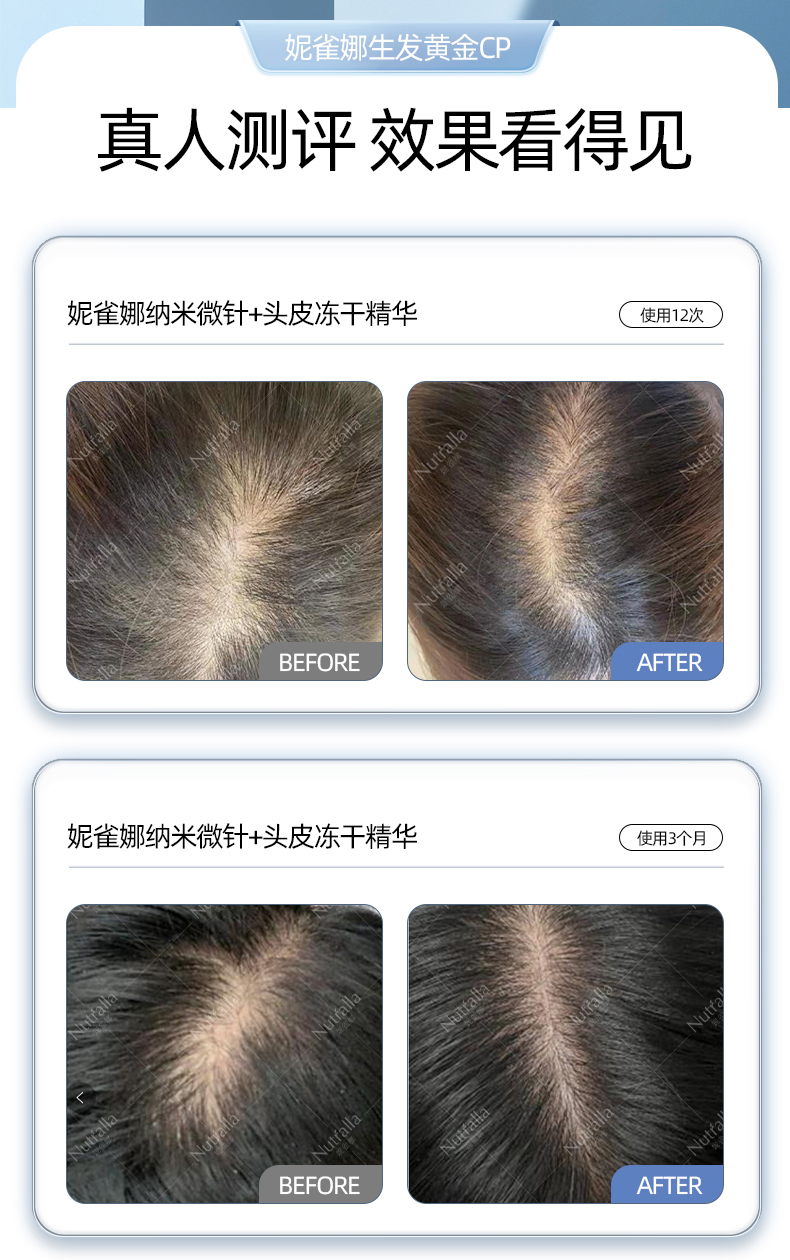 微针详情页_15.jpg