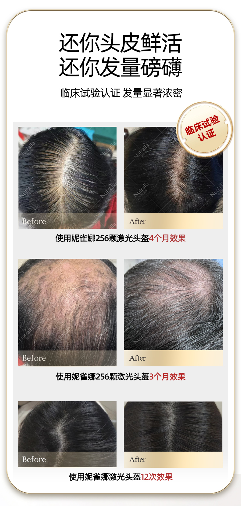 小蓝帽-上半部分_15.jpg