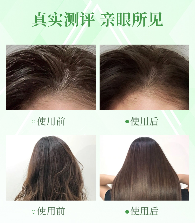 控油舒缓生机洗发水_11.jpg