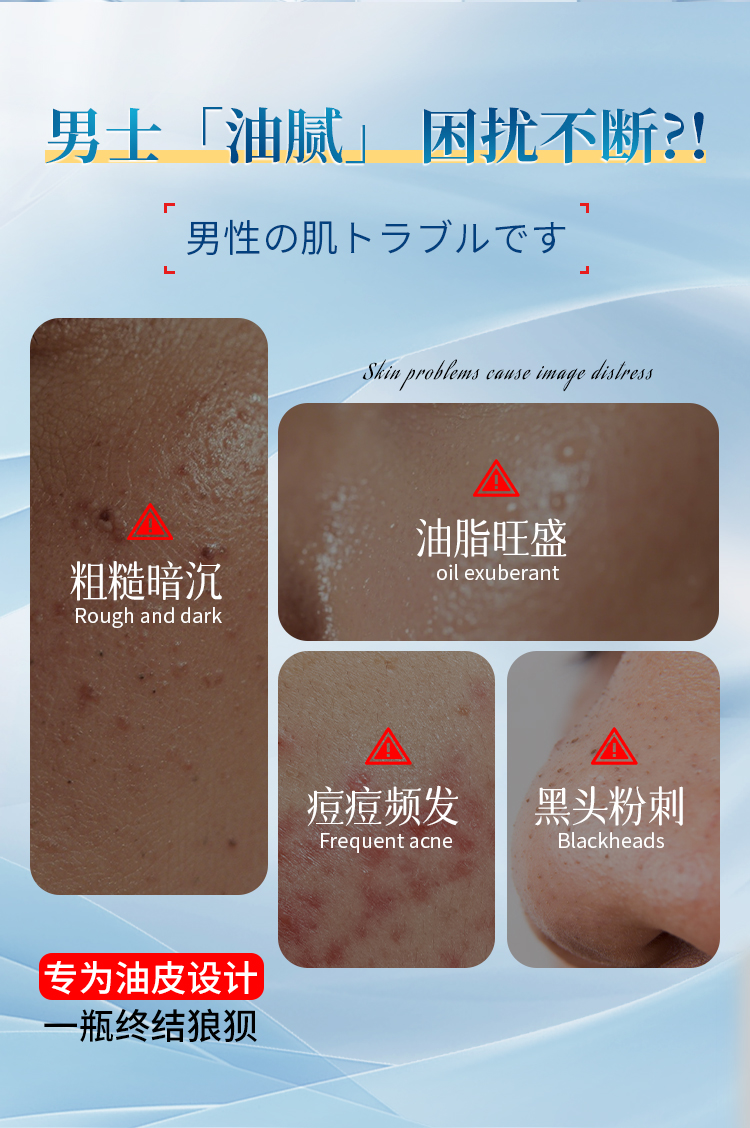 控油_02.jpg