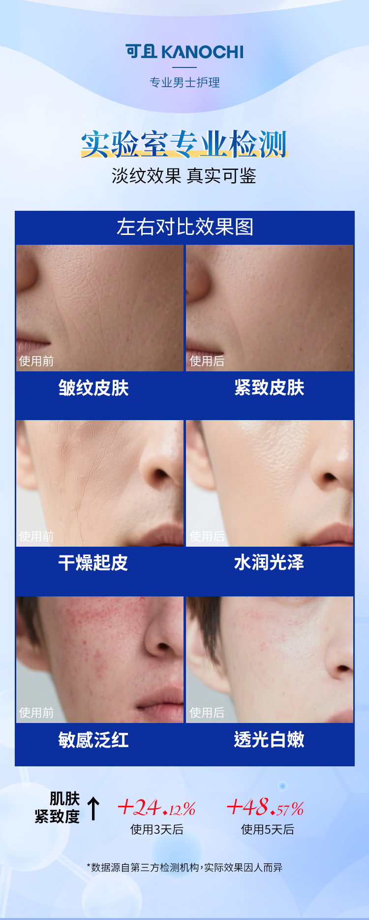抗皱_06.jpg