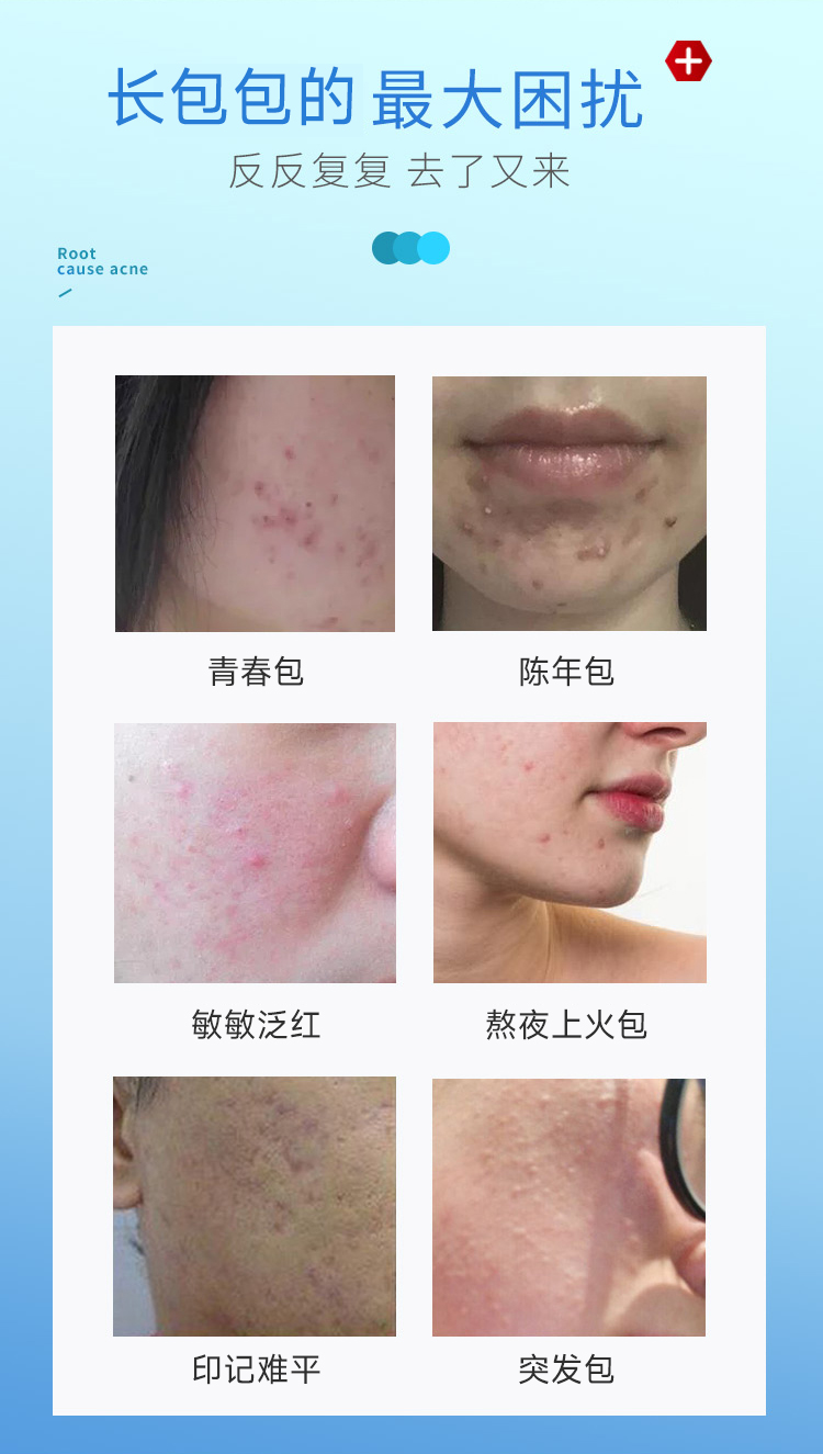 去痘详情页_02.jpg