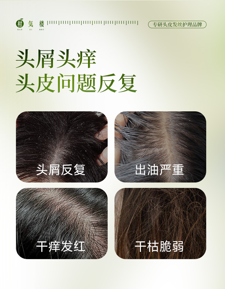 柑气楼去屑_03.jpg