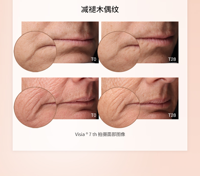 326D0D7321409F9816042CBBD7D4ED88.jpg 铂金生机面霜详情页260122_04.jpg