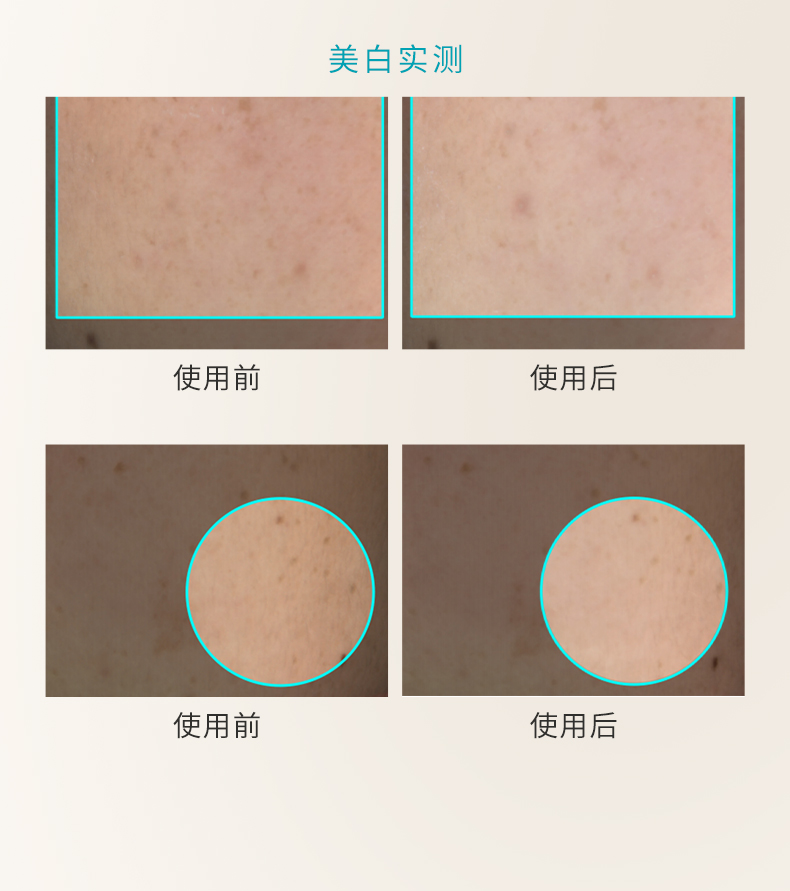 枫缇亮肤美白淡斑胶囊精华详情_08.jpg